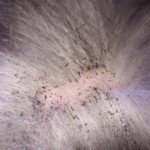fleas2